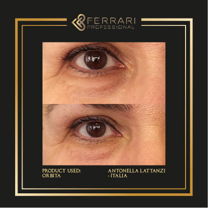 Mesoterapia Orbita 5x5ml