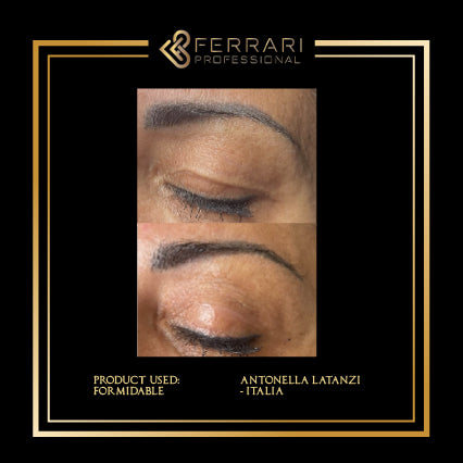 Filler PDRN Formidable 1x2ml (pré-embalado)