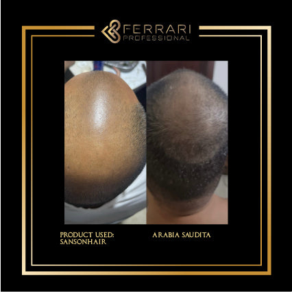 Mesoterapia SansonHair 5x5ml