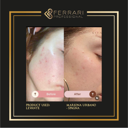 Peeling Levante 5x5ml